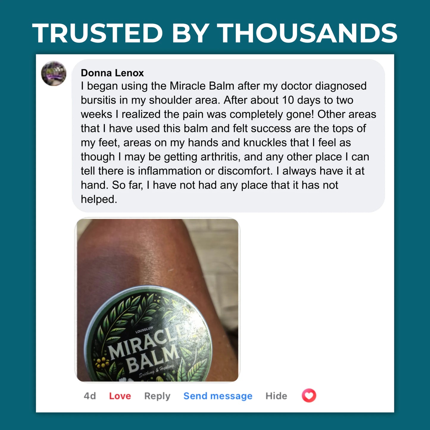 Louxgluw Miracle Balm | Say Goodbye to Heavy Swollen Legs in Just 7 Days